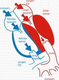 HOCM-T